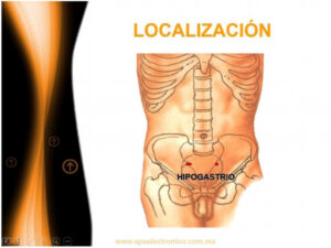 LOCALIZACION - Firefly Upscaler, escala 2x