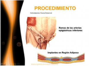 PROCEDIMIENTO 2 - Firefly Upscaler, escala 2x