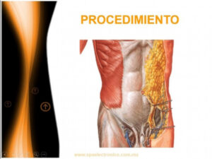 PROCEDIMIENTO - Firefly Upscaler, escala 2x