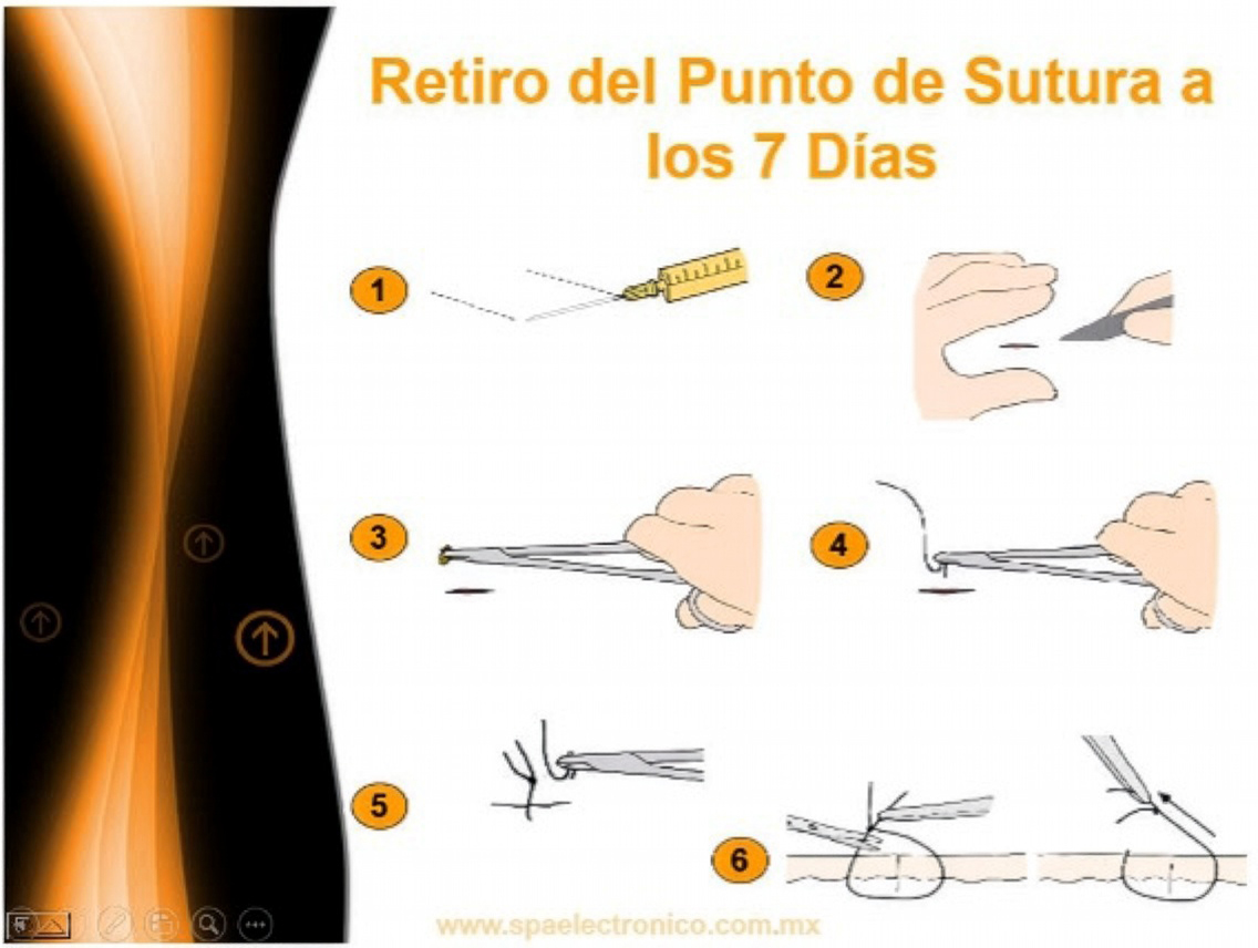 RETIRO - Firefly Upscaler, escala 2x